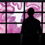 A Person looking at a digital pathology power wall image